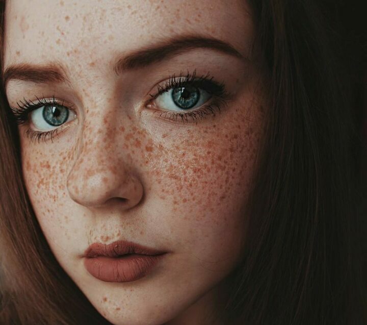 Dark Haired Girl With Freckles