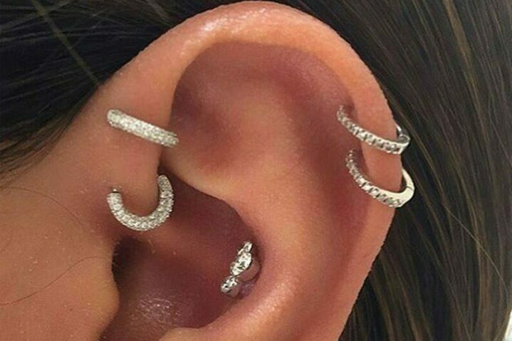 После прокола хрящ сколько болит и как долго заживает